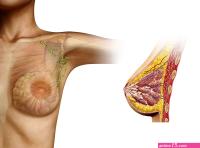 COVID Vaccine Side Effects May Mirror Breast Cancer Symptoms