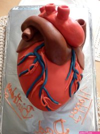 Cardiac Bypass