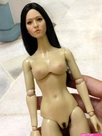 Reversible Pubic Hair Implantation