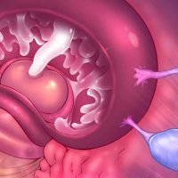 anime cervix sex
