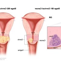 anime cervix sex