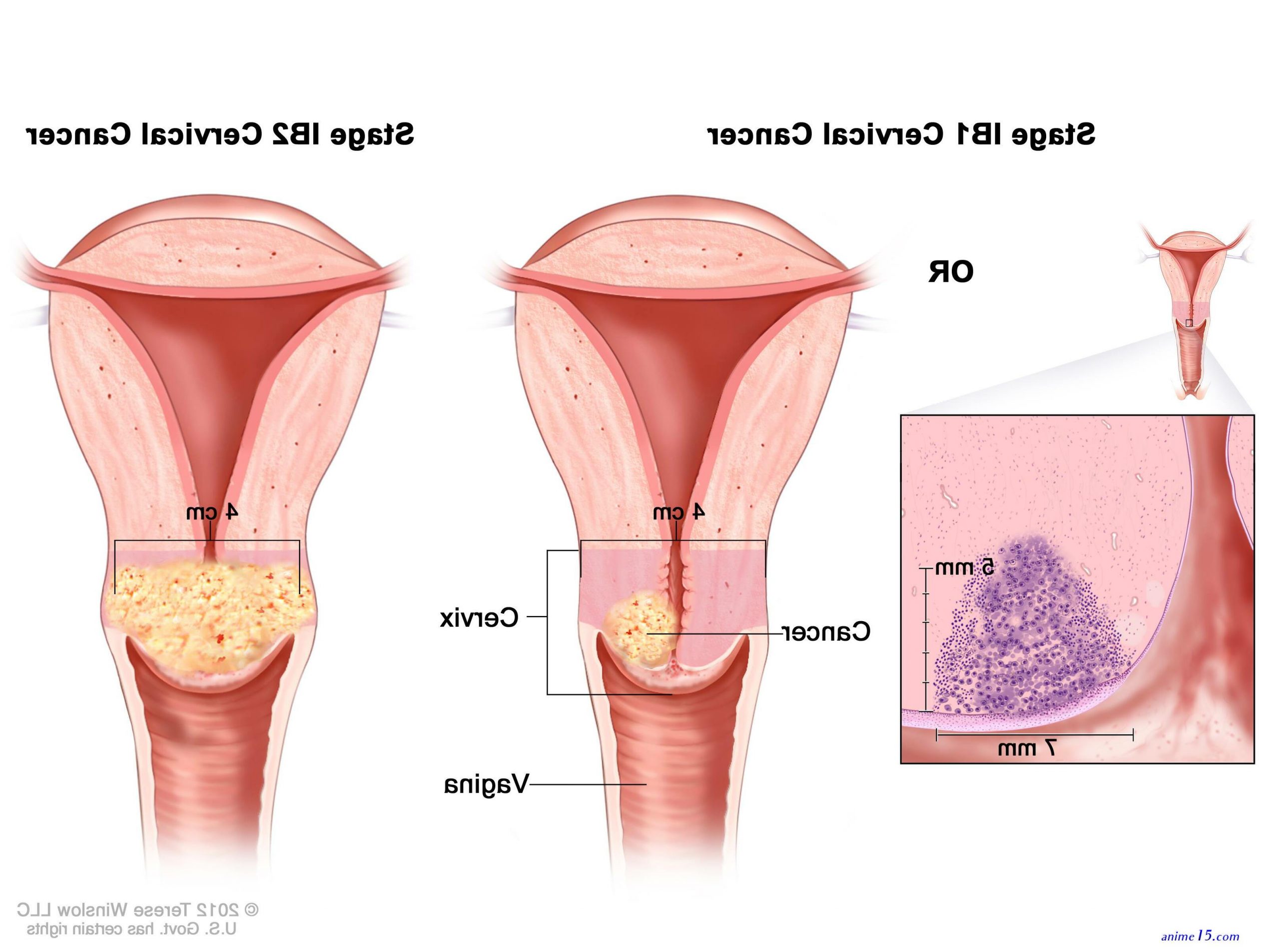 anime cervix sex
